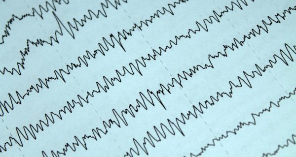 Scientists Improve Delirium Detection Using AI and Rapid-Response EEGs