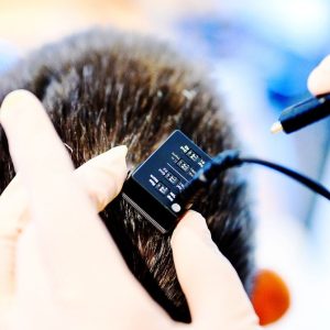 Brain Implants That Help Paralyzed People Speak Just Broke New Records